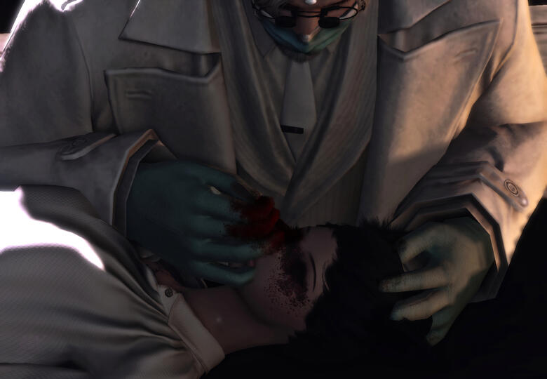 Enucleation process. The entire globe and a portion of the disabled optic nerve were removed, replaced with the OptiCore and connected to the patient&#39;s remaining optic nerve tissue.